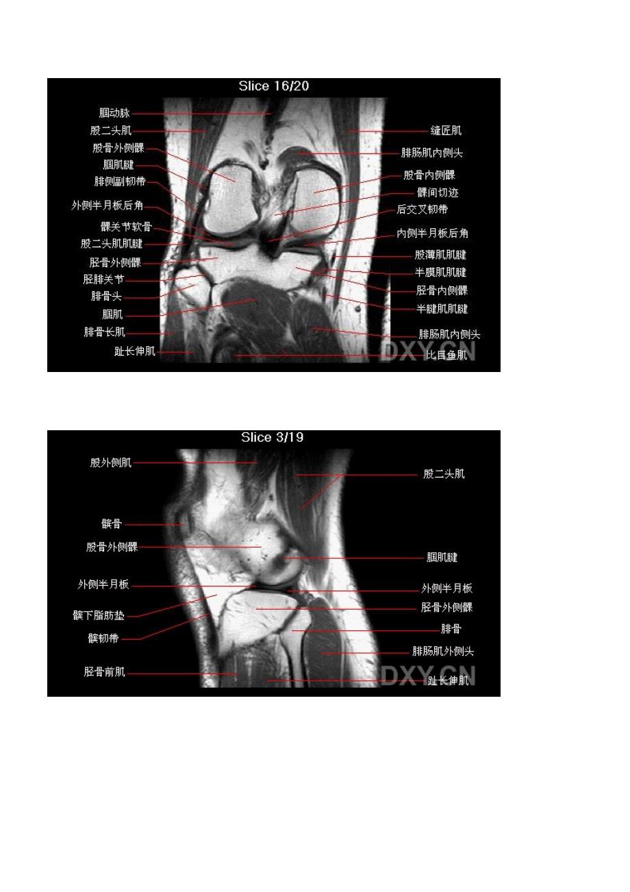 核磁共振MRI的正常影像-头颈脊柱膝关节.doc_第5页
