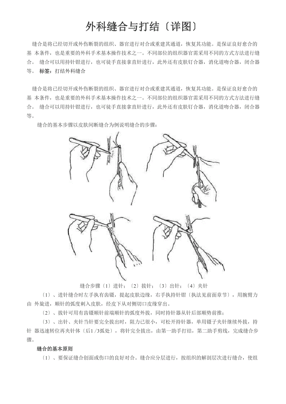 外科缝合与打结_第1页