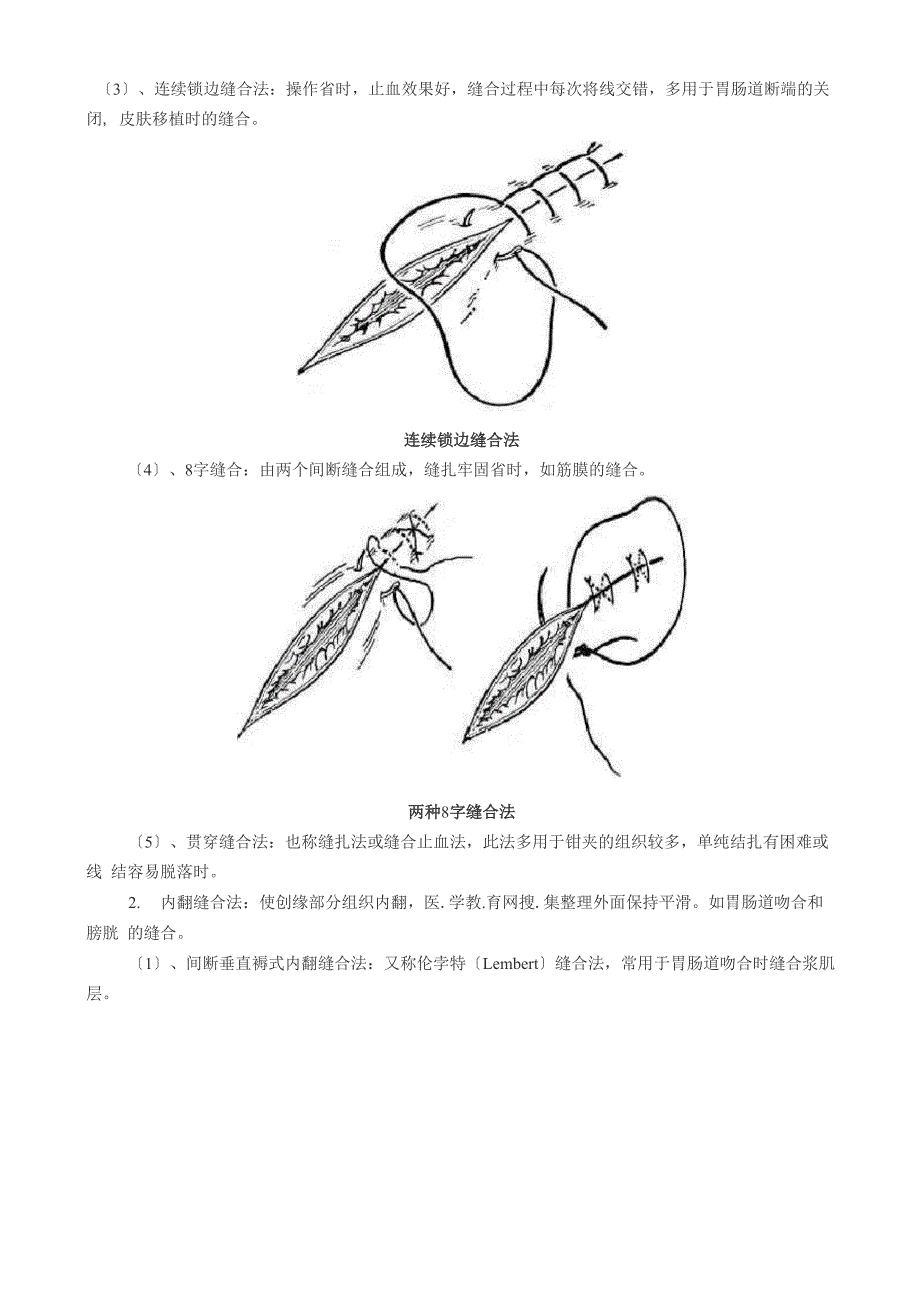 外科缝合与打结_第3页