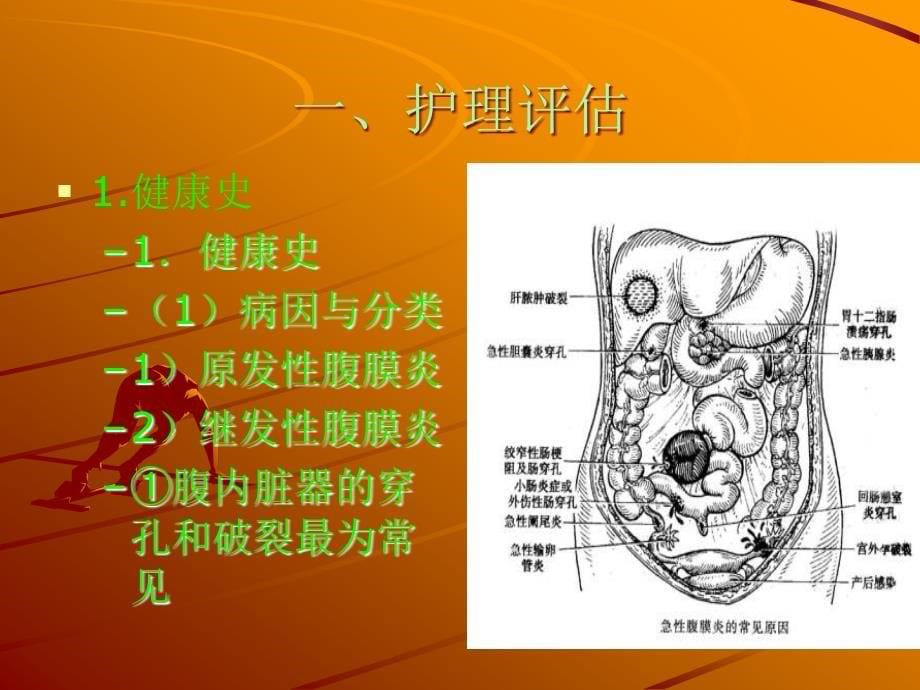 第16章急性腹膜炎与腹部损伤病人的护理_第5页