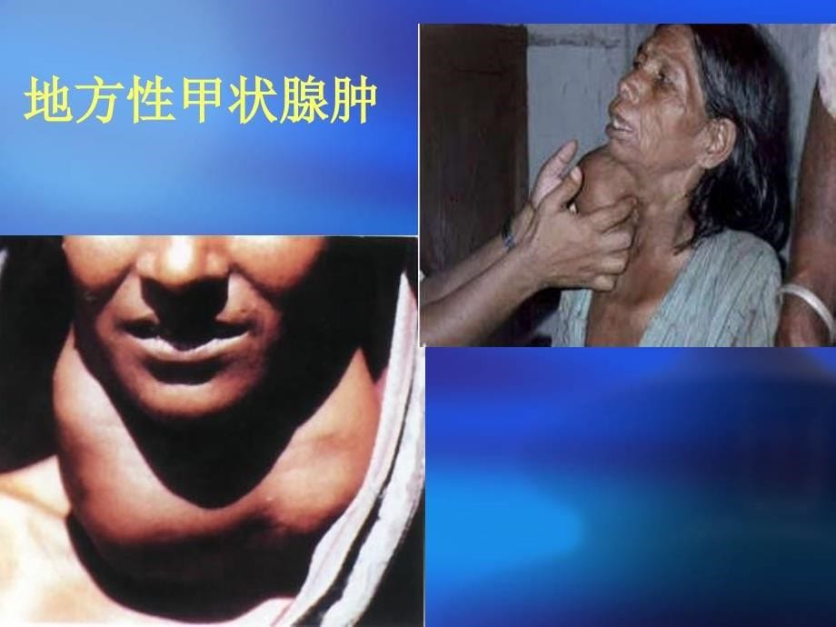 环境污染与人体健康_第5页