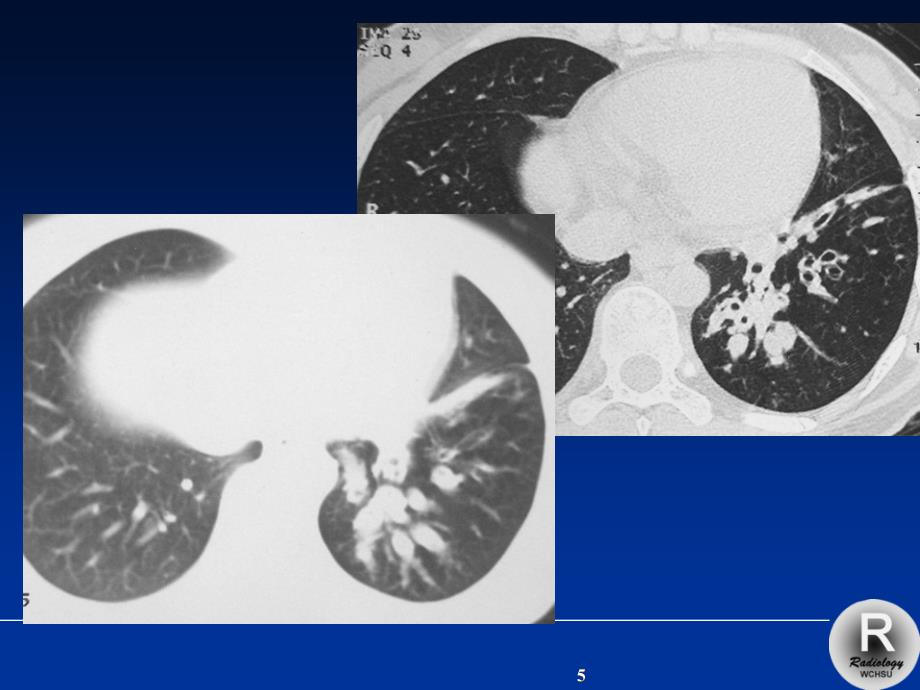 胸部X线诊断课件严选材料_第5页