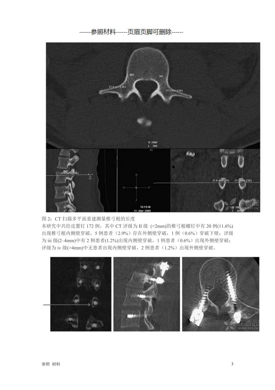 手术技巧：经皮胸、腰椎弓根螺钉置入技术[参照类别]_第3页