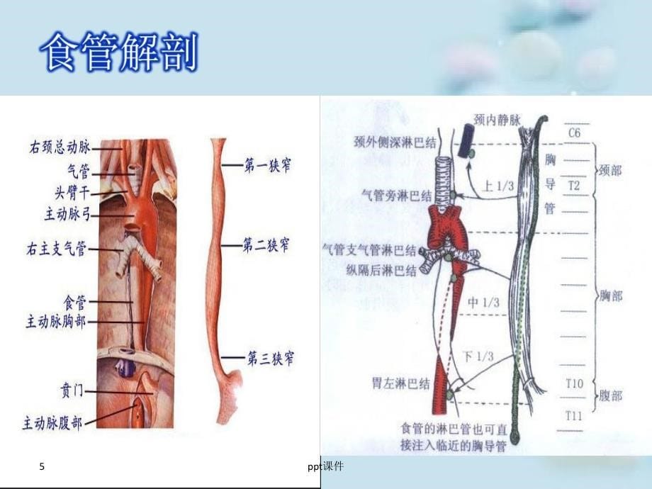 食管癌术后护理查房--ppt课件_第5页