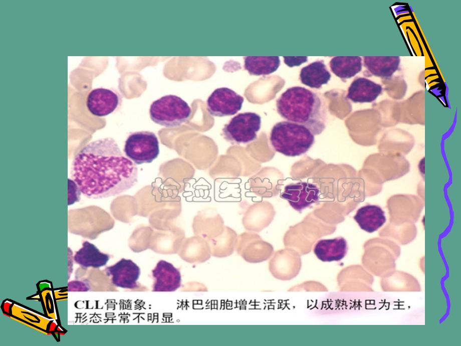 定义骨髓中的干细胞具有自我更新能力并能分化为各ppt课件_第4页