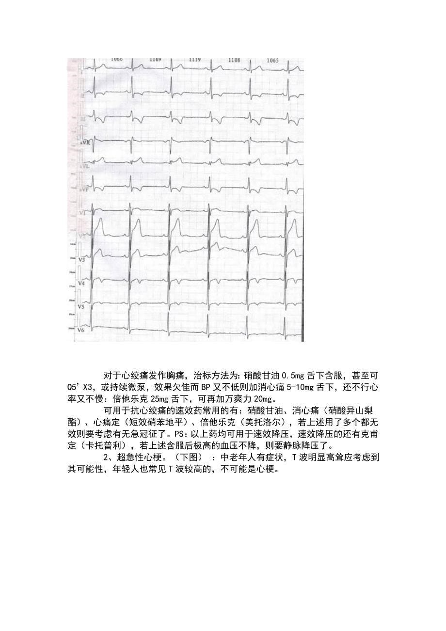 心电图原来也可以这么简单(精品)_第5页