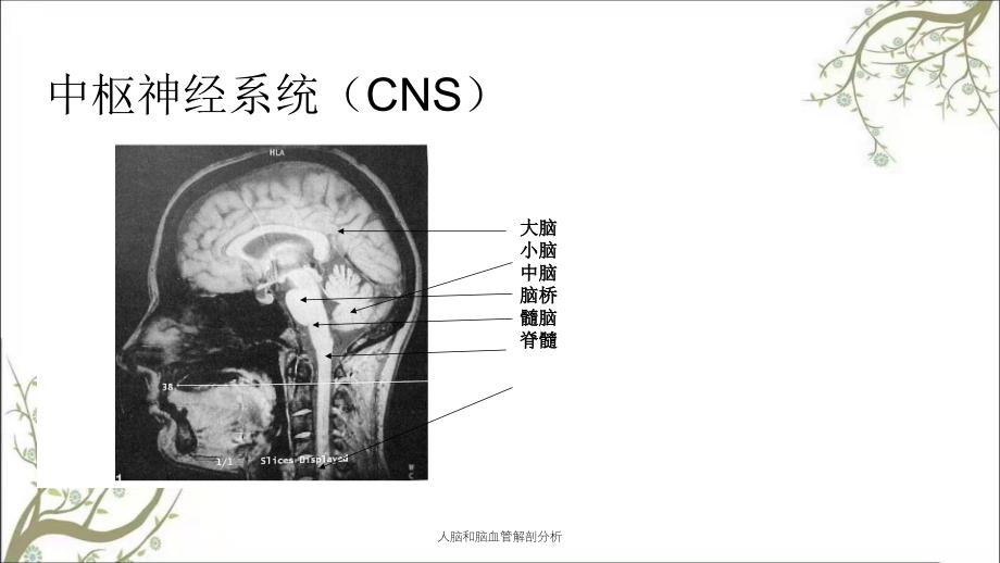 人脑和脑血管解剖分析_第3页