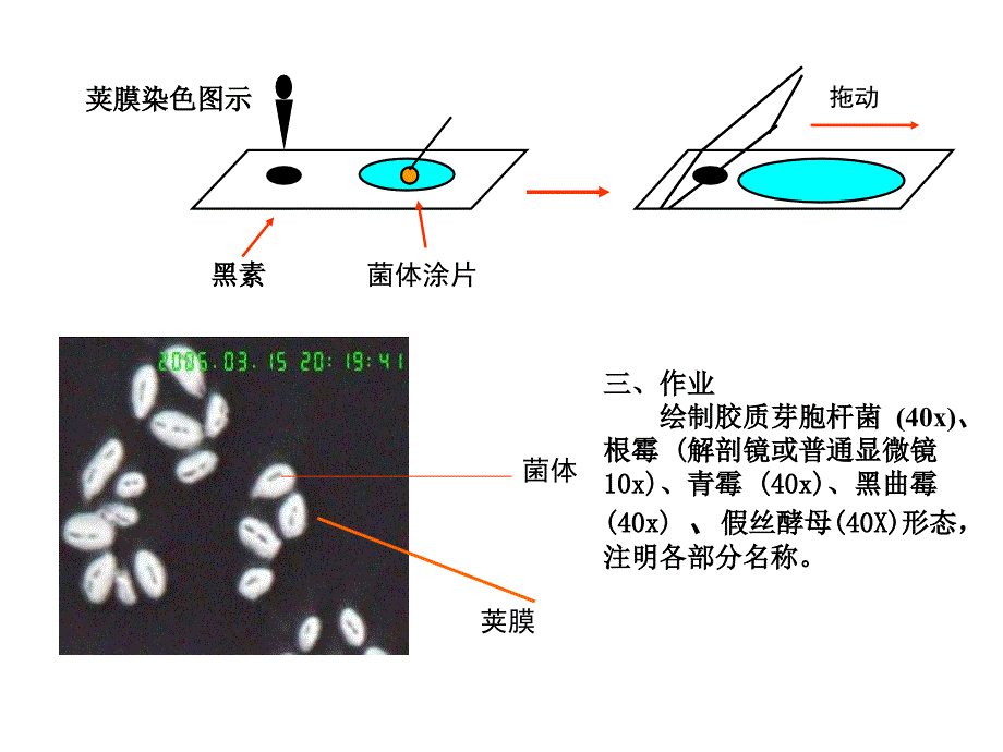 荚膜真菌观察_第3页