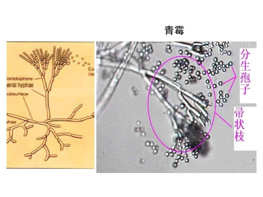 荚膜真菌观察_第5页