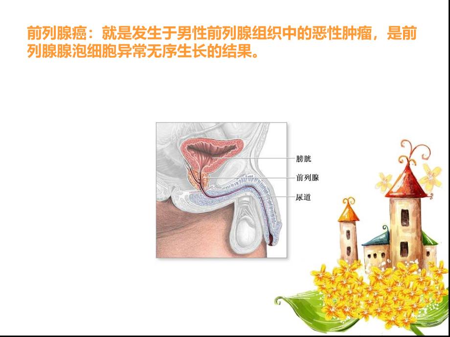 前列腺癌的护理查房ppt课件_第3页