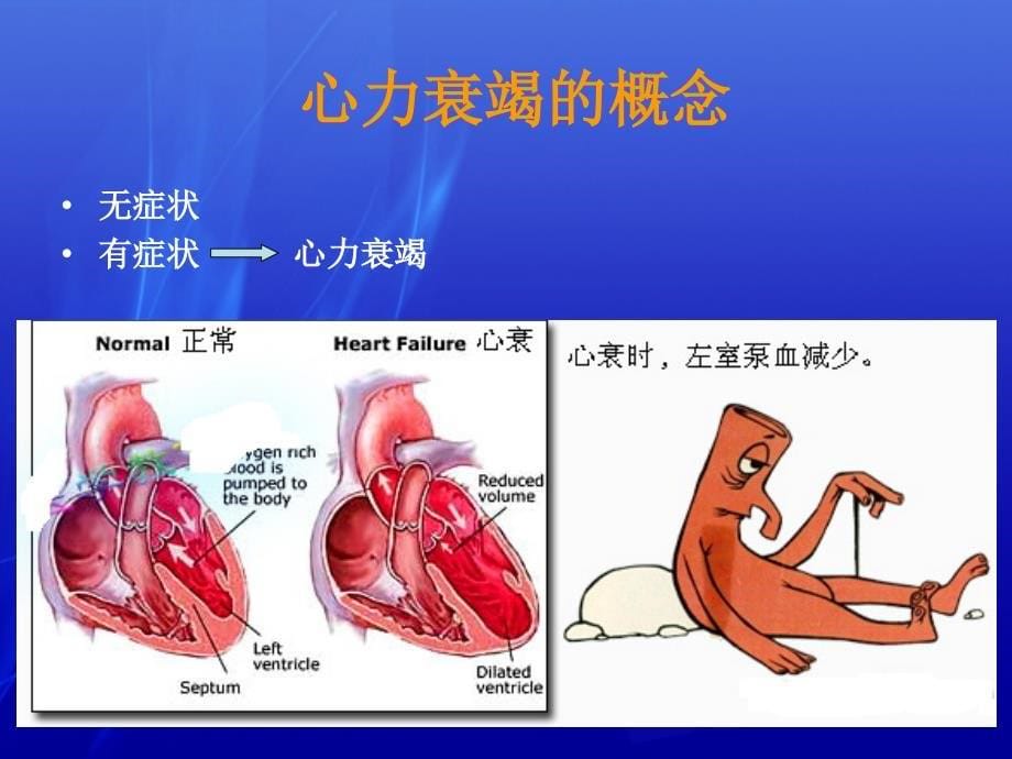 心力衰竭PPT课件_第5页