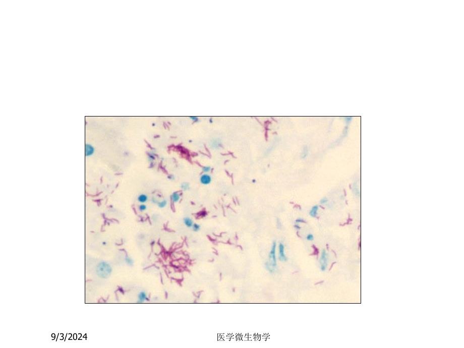 医学微生物学课件第11章分枝杆菌属_第3页