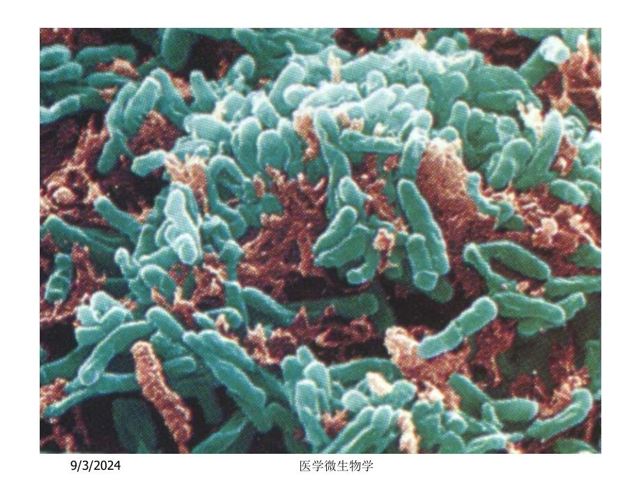 医学微生物学课件第11章分枝杆菌属_第4页