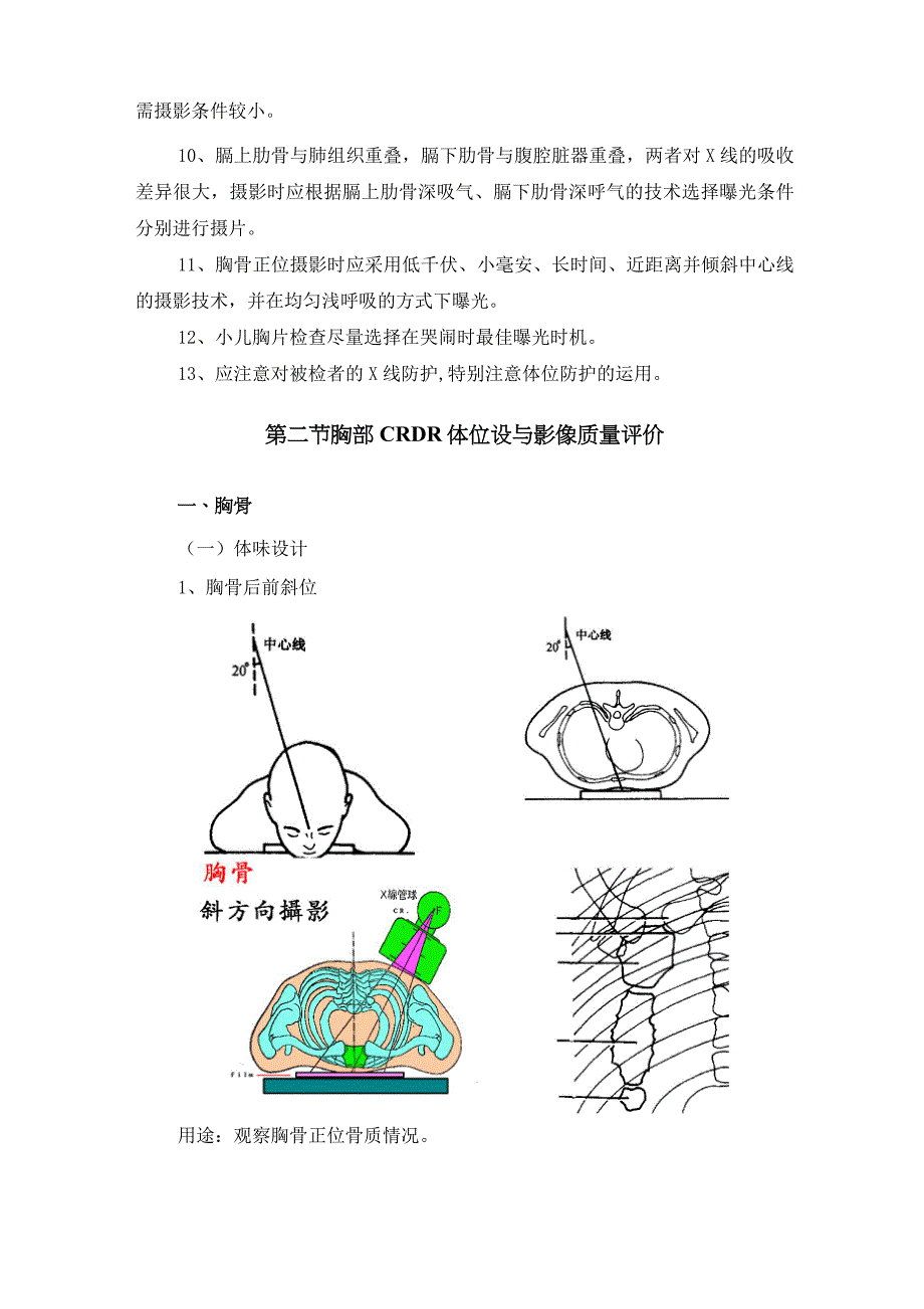 06第六章 胸部数字X线体位设计与影像质量评价解析_第2页