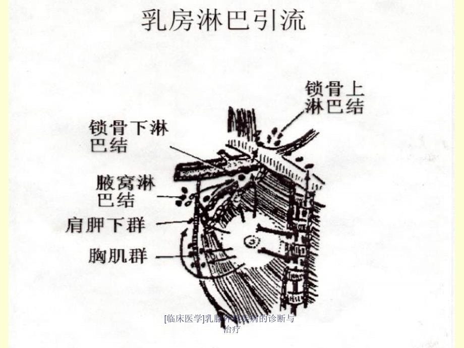 临床医学乳腺外科疾病的诊断与治疗课件_第5页