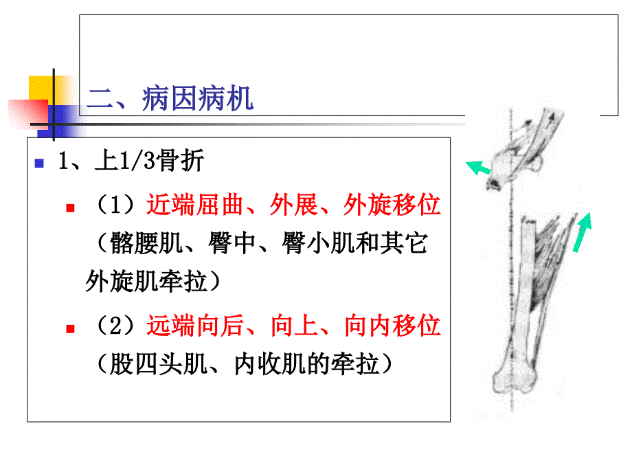 最新：股骨干折课件文档资料_第4页