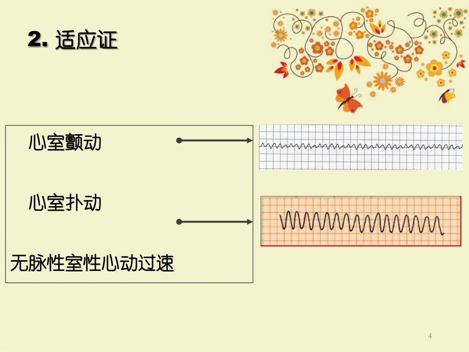 心脏电除颤术_第4页