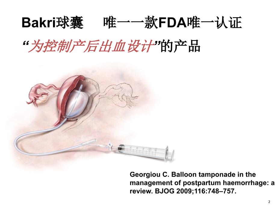 BAKRI子宫填塞球囊导管课件_第2页