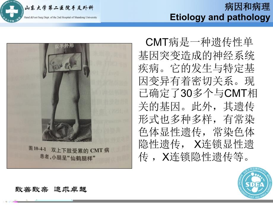 遗传性运动感觉神经病CMT_第4页