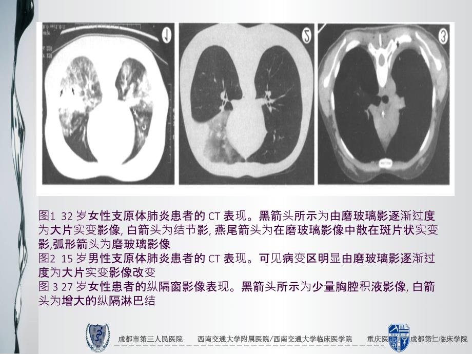 成人支原体肺炎专家共识ppt课件_第4页