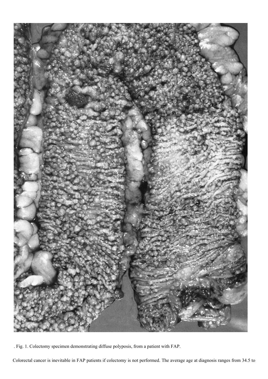 2001遗传型结肠癌及基因检测专业评述（英文）-AGA.doc_第2页