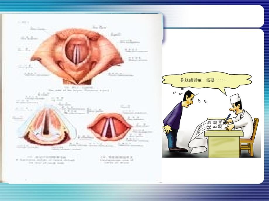 声带及其相关疾病简介_第2页