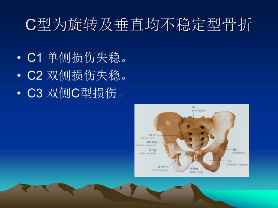 骨盆骨折护理常规_第4页