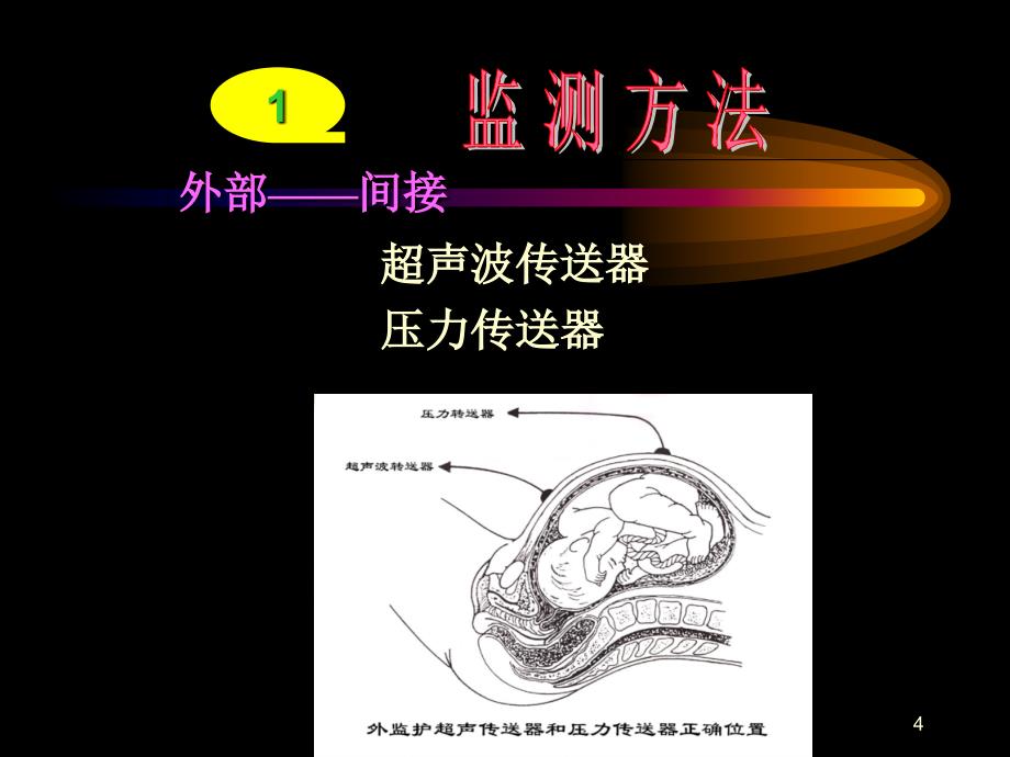 电子胎心监护中大学湘雅二医院文档资料_第4页