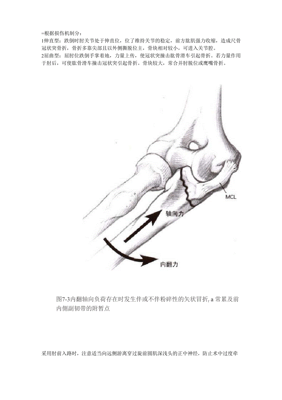 尺骨冠突骨折的分型及治疗_第3页