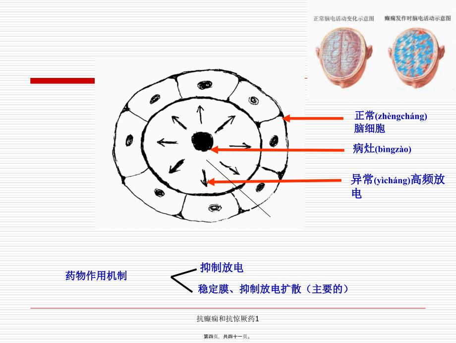 抗癫痫和抗惊厥药1课件_第4页