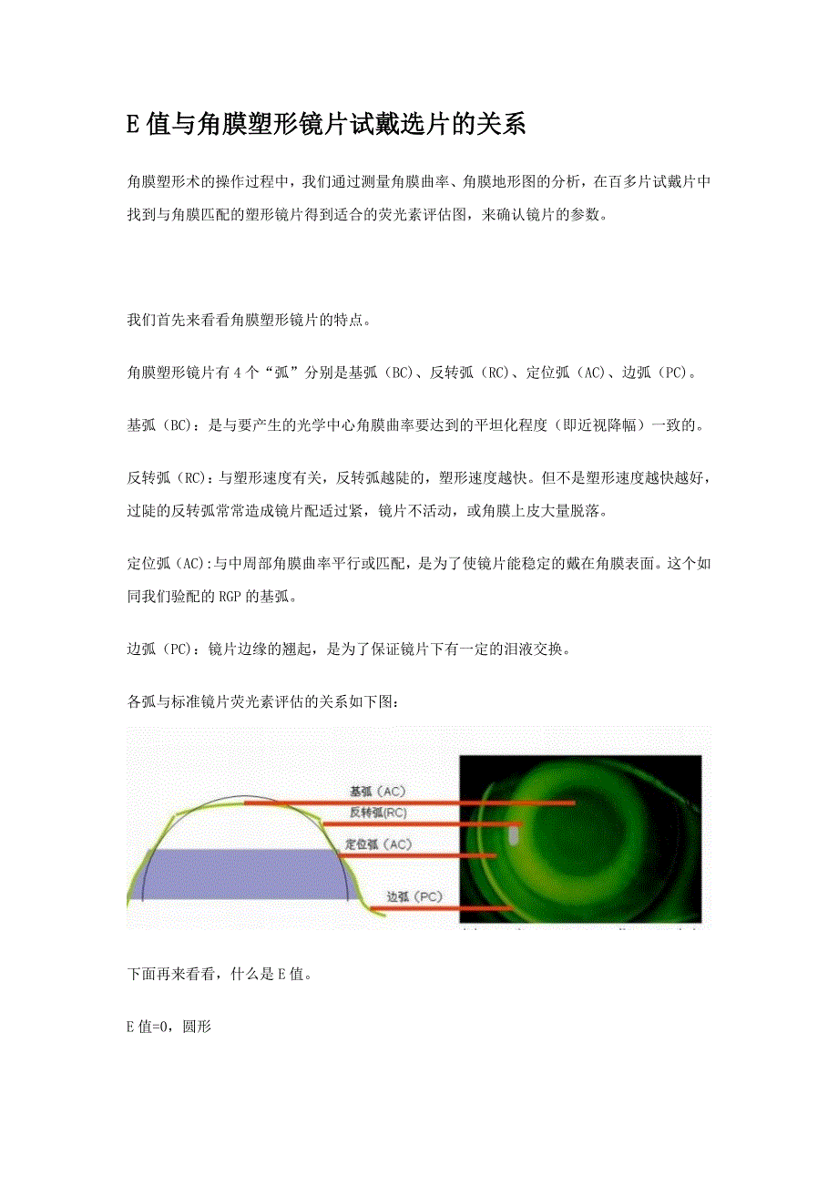 E值与角膜塑形镜片试戴选片的关系.doc_第1页