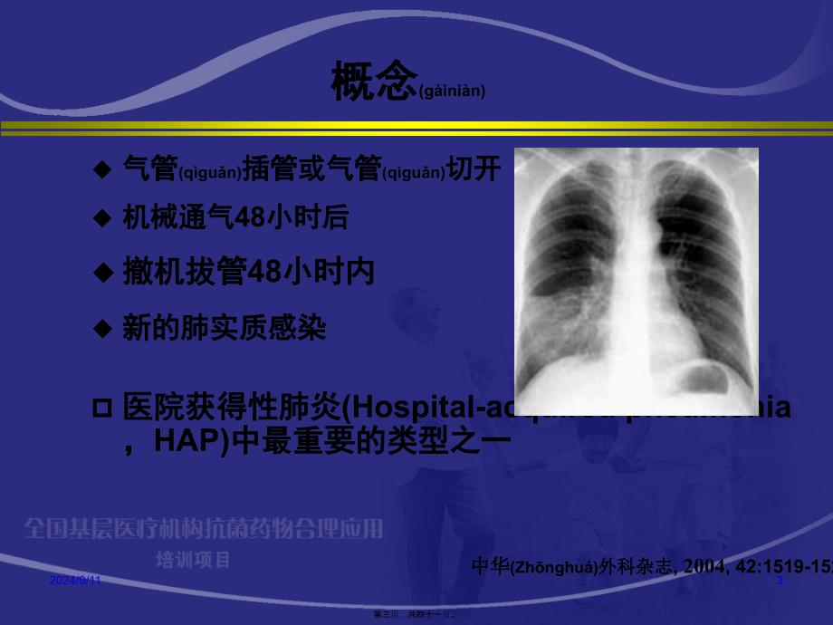 医学专题—呼吸机相关性肺炎杨毅描述12251_第3页