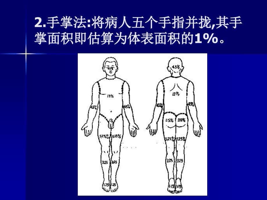 急性烧烫伤的急救PPT课件_第5页