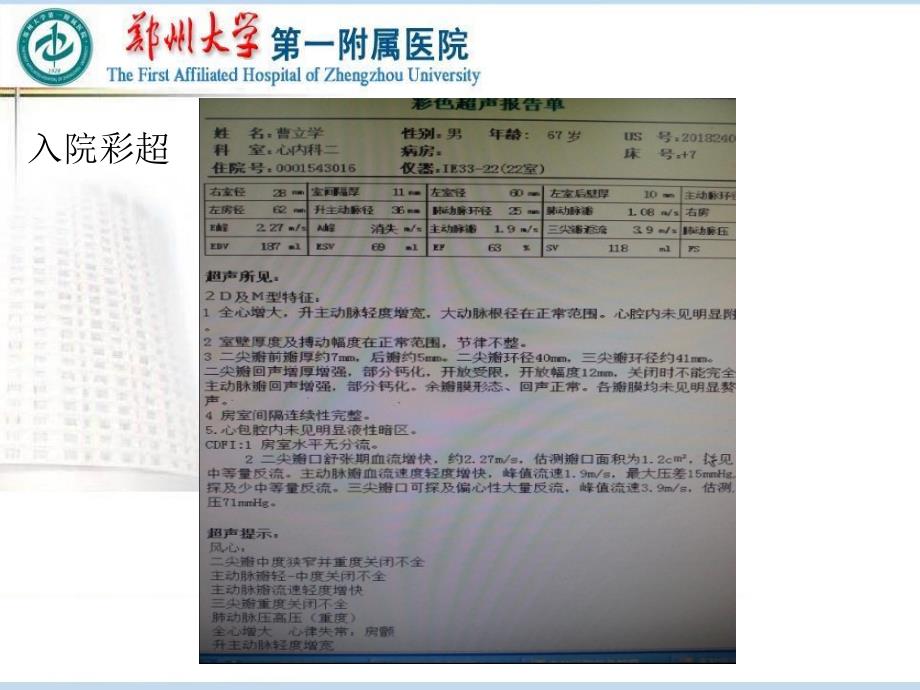 王岩感染性心内膜炎_第4页