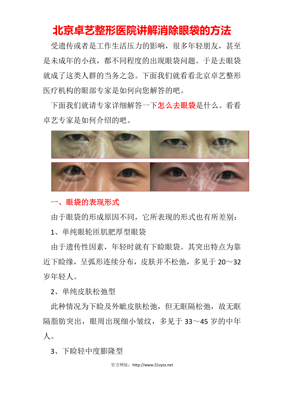 消除眼袋的方法.doc_第1页