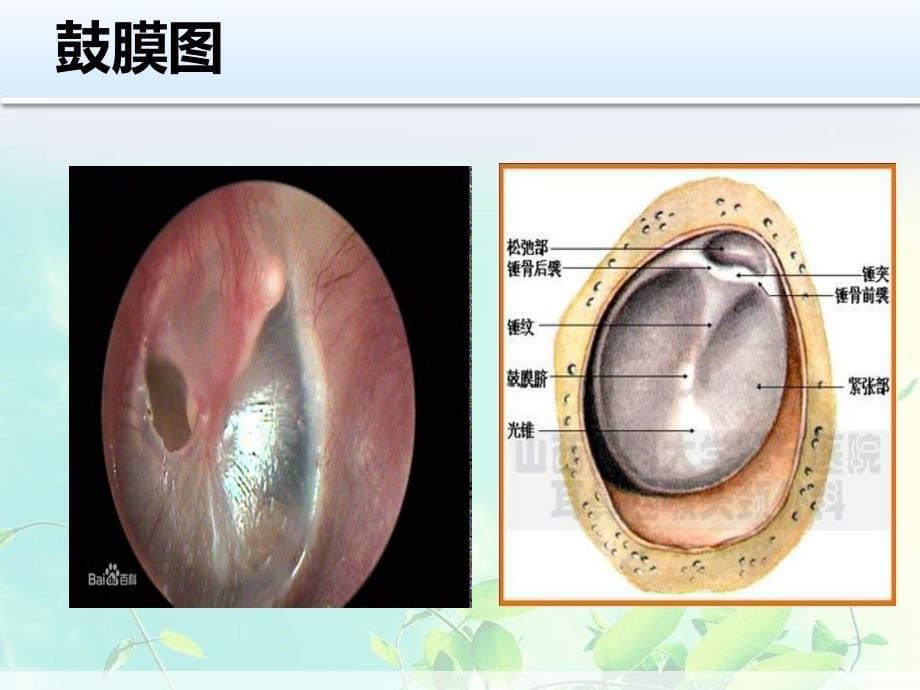 鼓膜外伤病人的护理_第5页