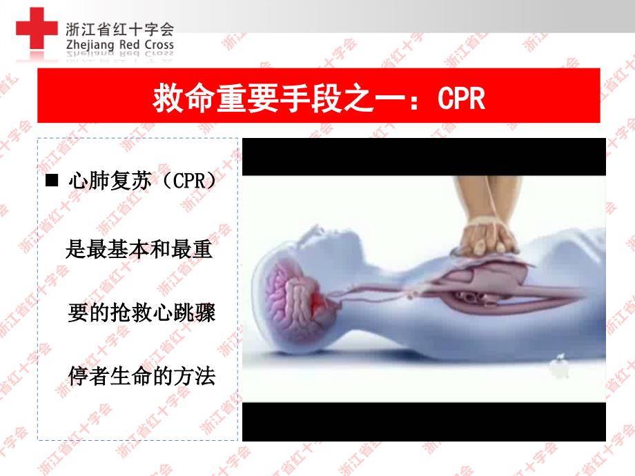 心肺复苏在现场救护中意义及实施方法_第4页