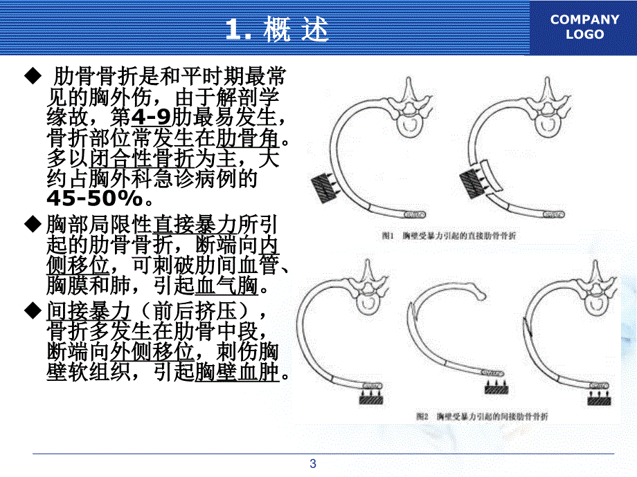 肋骨骨折的外科治疗_第3页