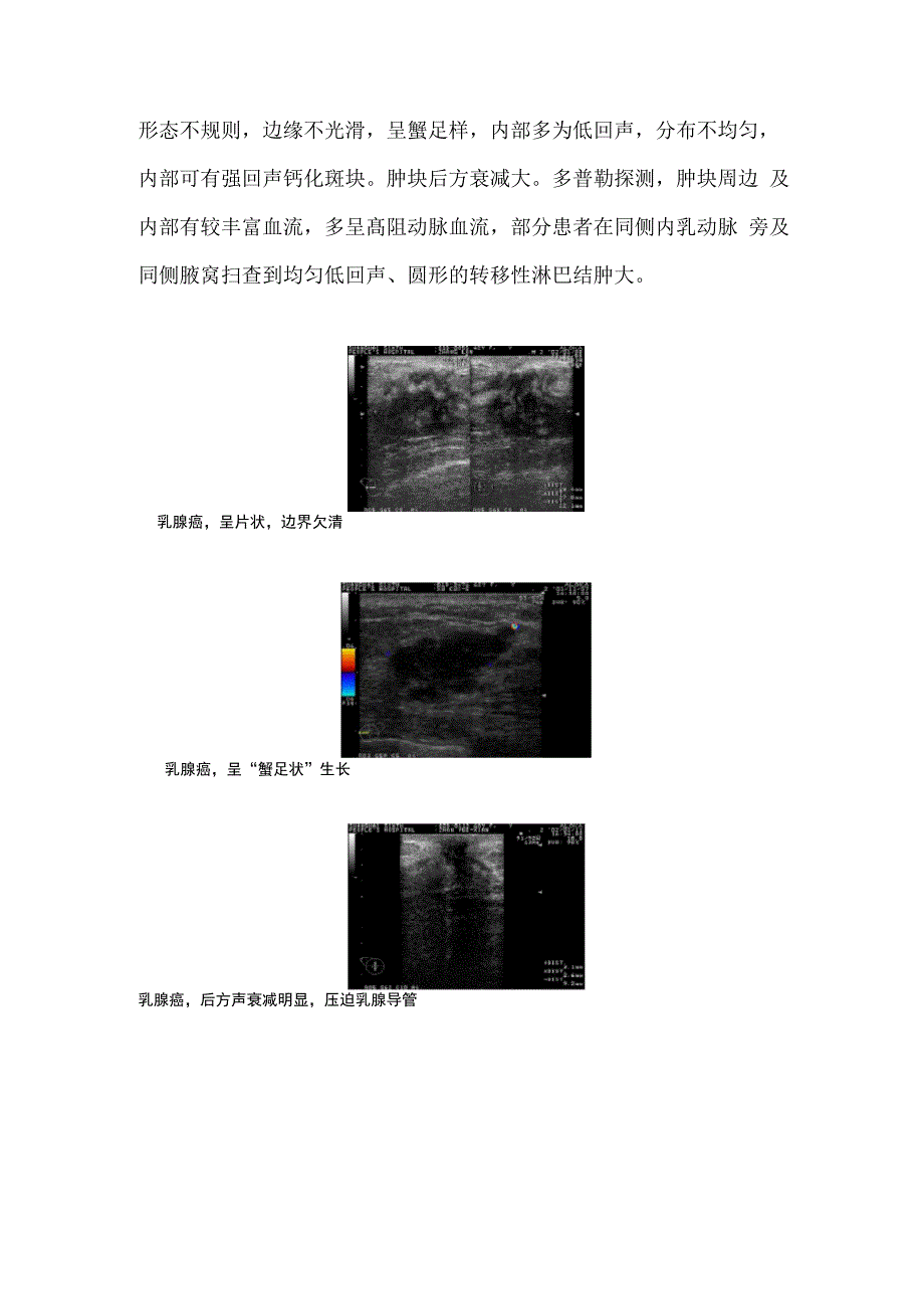 乳腺疾病诊断_第4页