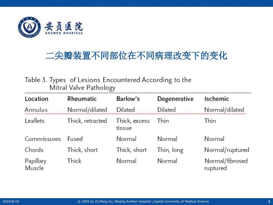 尖瓣成形环的合理应用_第2页