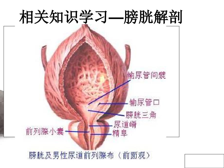 泌尿外科护理查房-(1)[1]_第3页