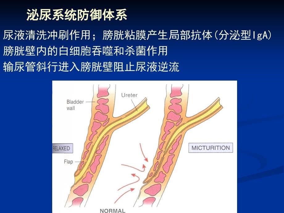 泌尿系统疾病2_第5页