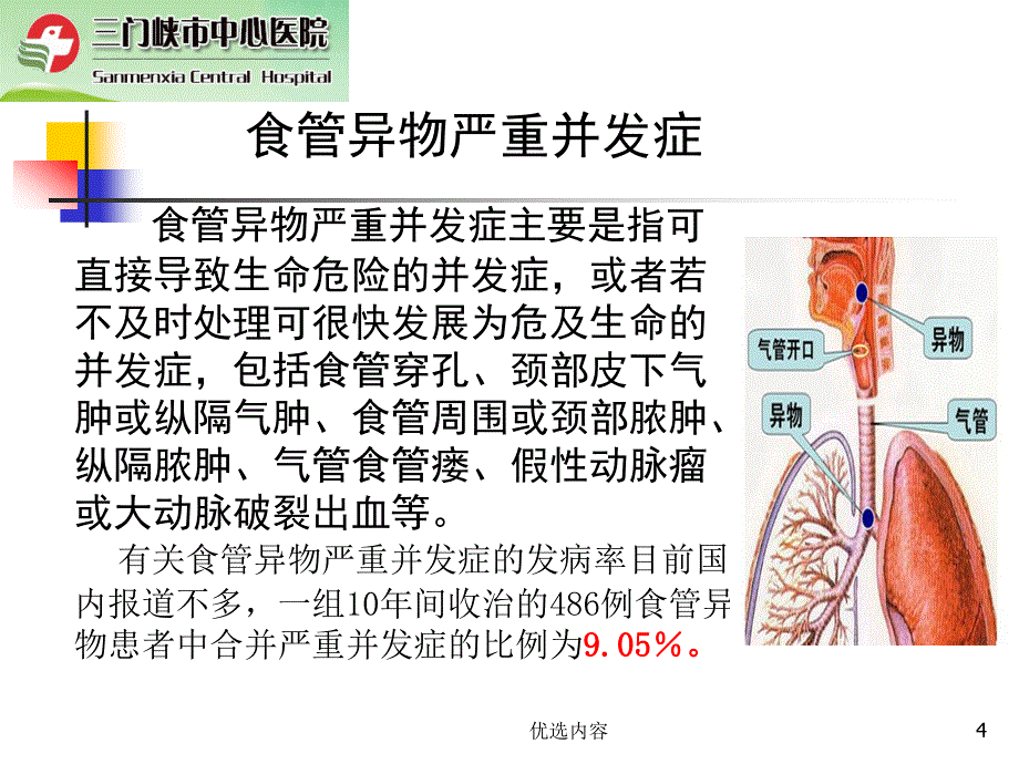 食道异物的诊断与治疗参考材料_第4页