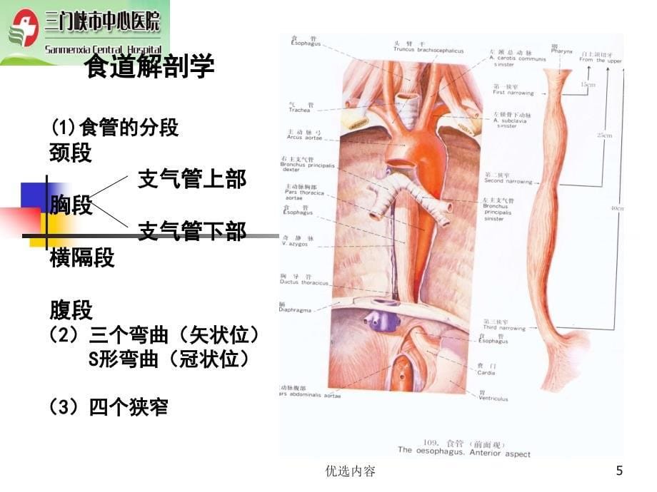 食道异物的诊断与治疗参考材料_第5页