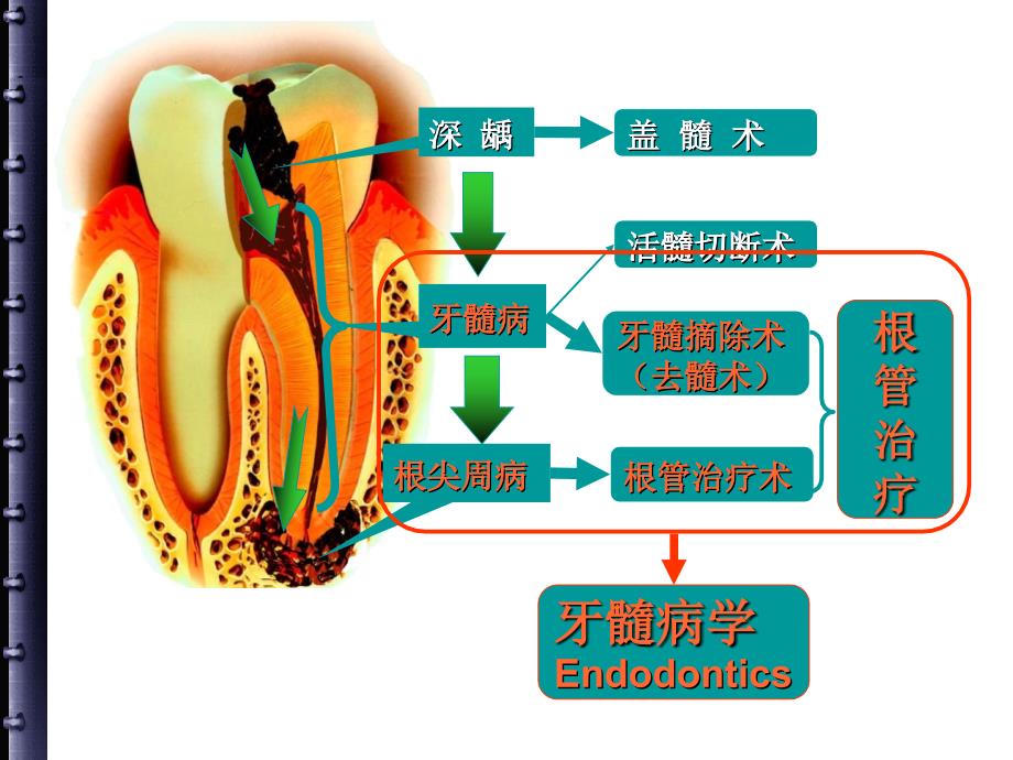 根管治疗的步骤、方法、器械_第2页