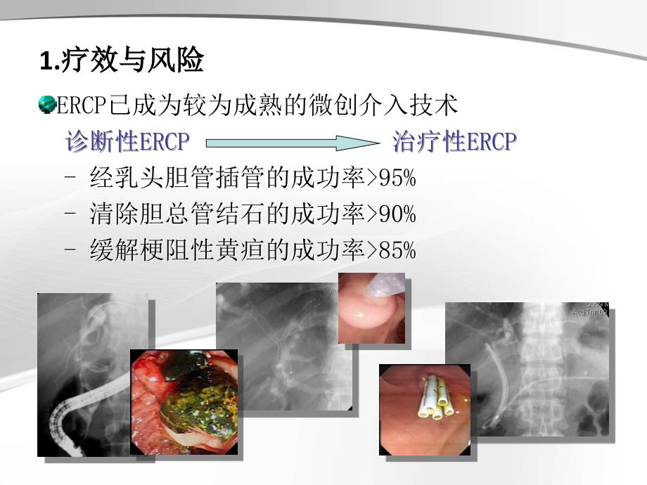 ercp治疗胆胰疾病ppt课件_第2页