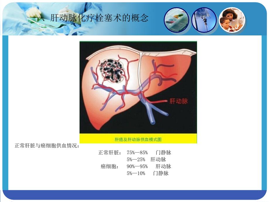 肝动脉化疗栓塞术ppt课件_第3页