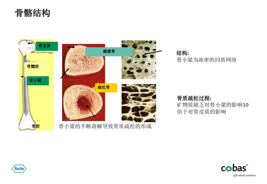 骨代谢标志物的临床应用_第4页