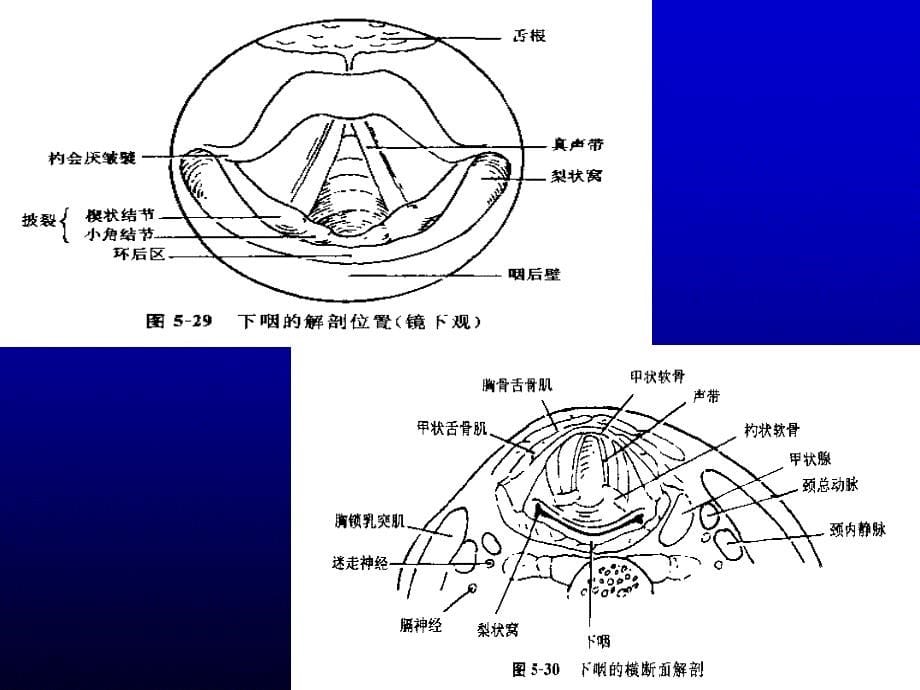 咽癌介入影像治疗_第5页