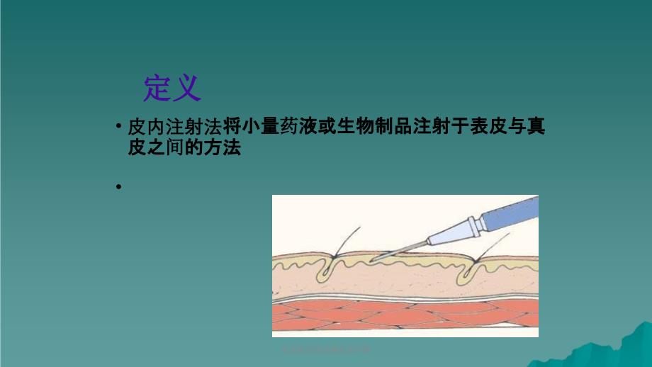 皮试肌注相关操作及护理课件_第3页